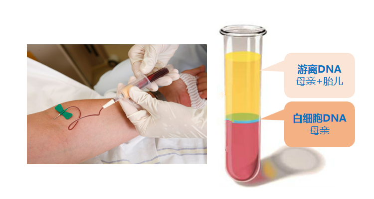  �����޴����Ӽ�����֪ͨ���³�Ѫ��ԭ����...