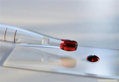 Ϊʲô��ͷ�����Ӽ��������ȿ���Ѫ��������