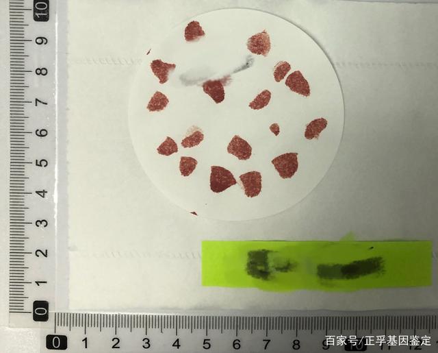 Ѫ�����Ӽ���Ӧ�������ɼ���Ʒ��